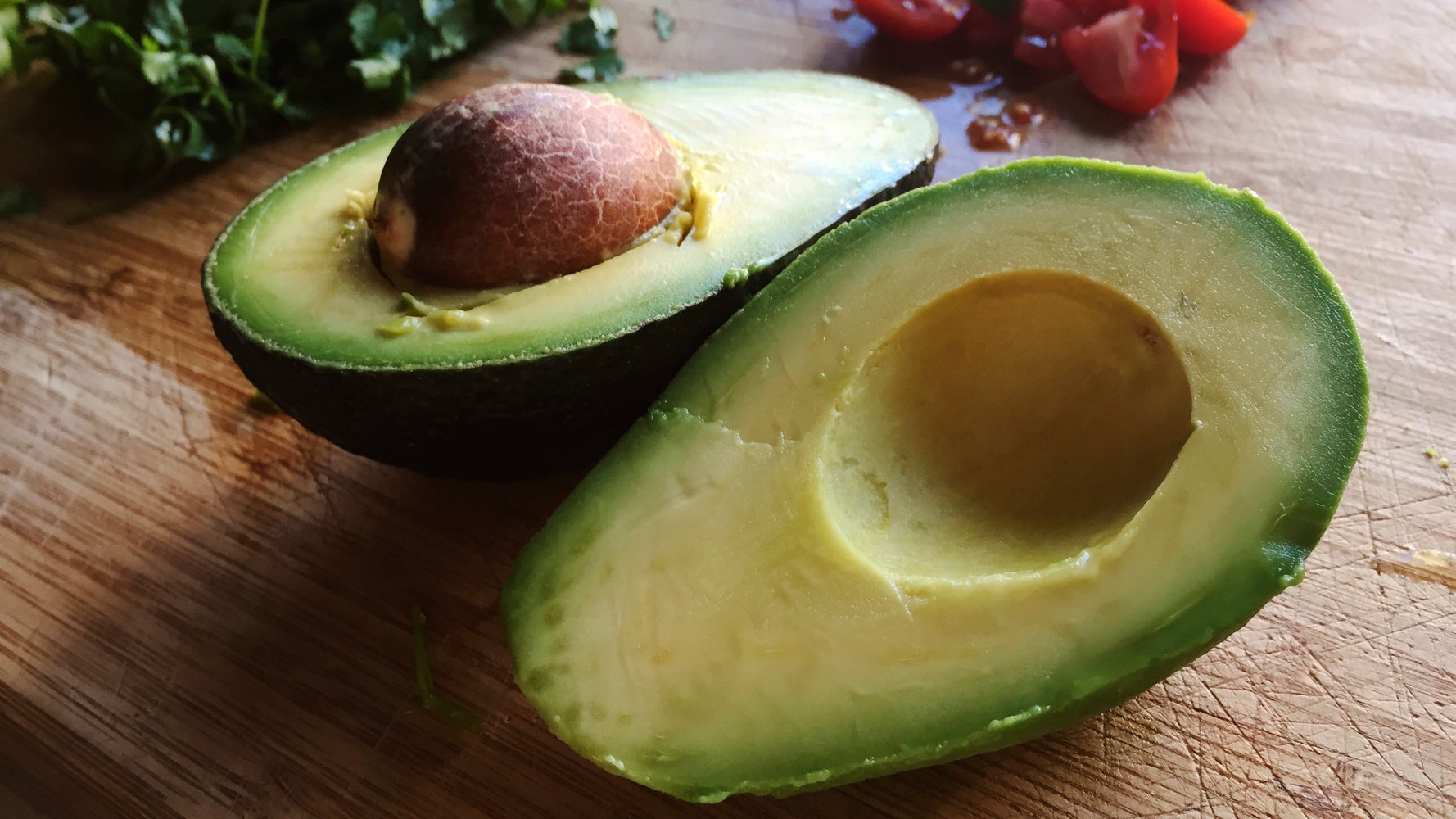 Warning Over Avocado Hand Cutting Risk As Brunch Fans Left With Nerve ...