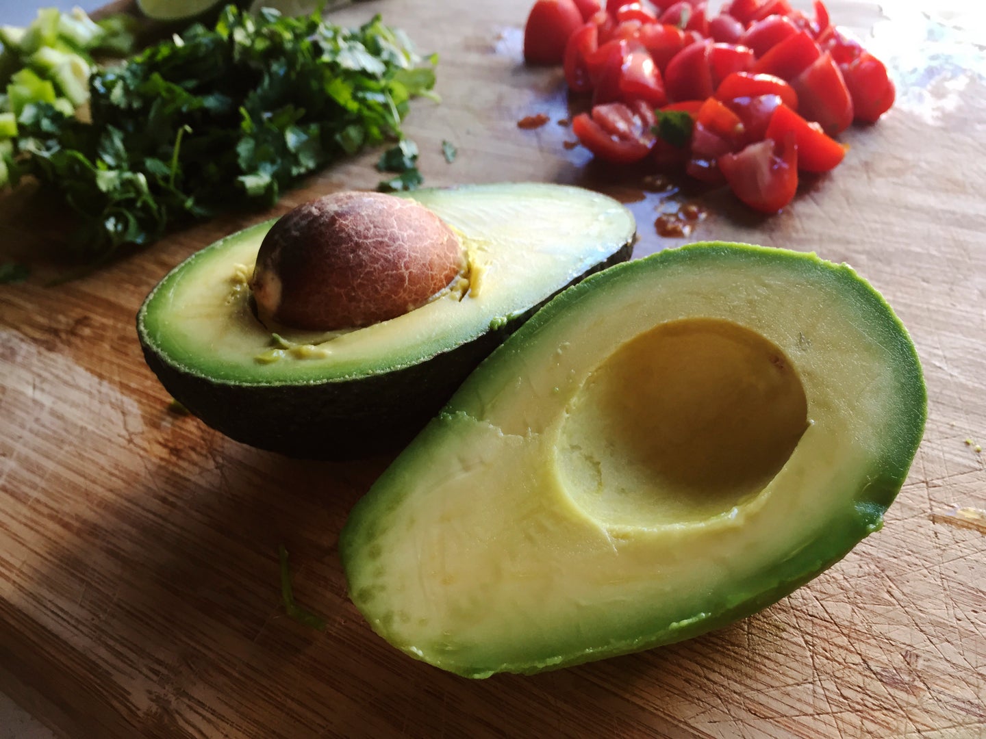 Warning Over Avocado Hand Cutting Risk As Brunch Fans Left With Nerve ...