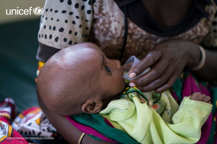 <p><em>A child suffering from severe acute malnutrition receiving therapeutic milk at UNICEF-supported clinic in Loiyangalani, Marsabit County in Kenya. UNICEF in collaboration with partners is responding to the drought by providing urgently needed therapeutic feeding supplies. </em> </p>