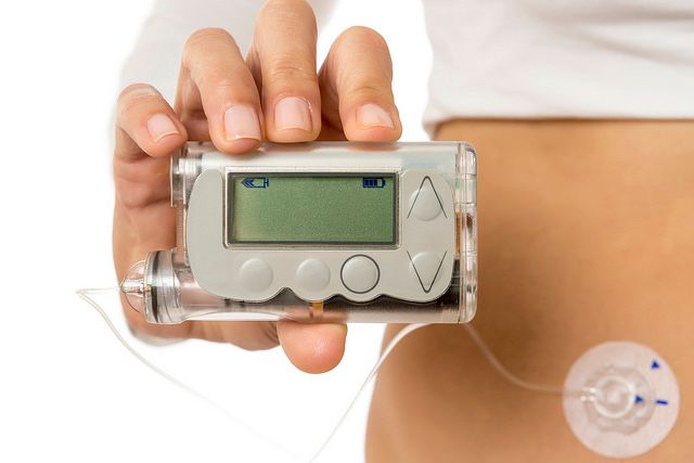 Digital insulin pump.