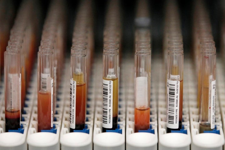 Blood samples waiting to be processed at a biobank.