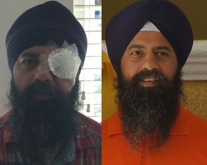 Maan Singh Khalsa after the Sept. 25 attack (left) and in a photo of him previously (right).