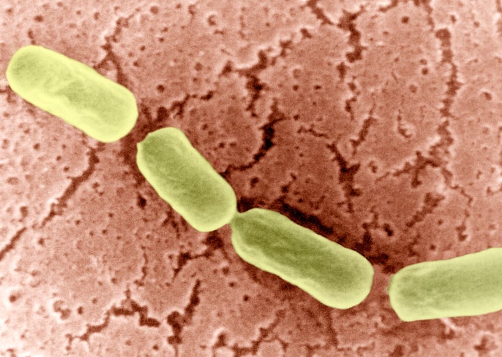 A toxin that causes botulism, which is spread through contaminated food or water, was found in the gas station's cheese,