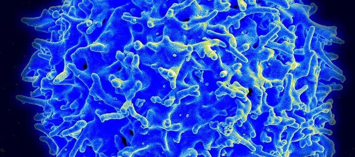 Scanning electron micrograph of a human T lymphocyte (also called a T cell) from the immune system of a healthy donor. Immunotherapy fights cancer by supercharging the immune system's natural defenses (include T-cells) or contributing additional immune elements that can help the body kill cancer cells. 