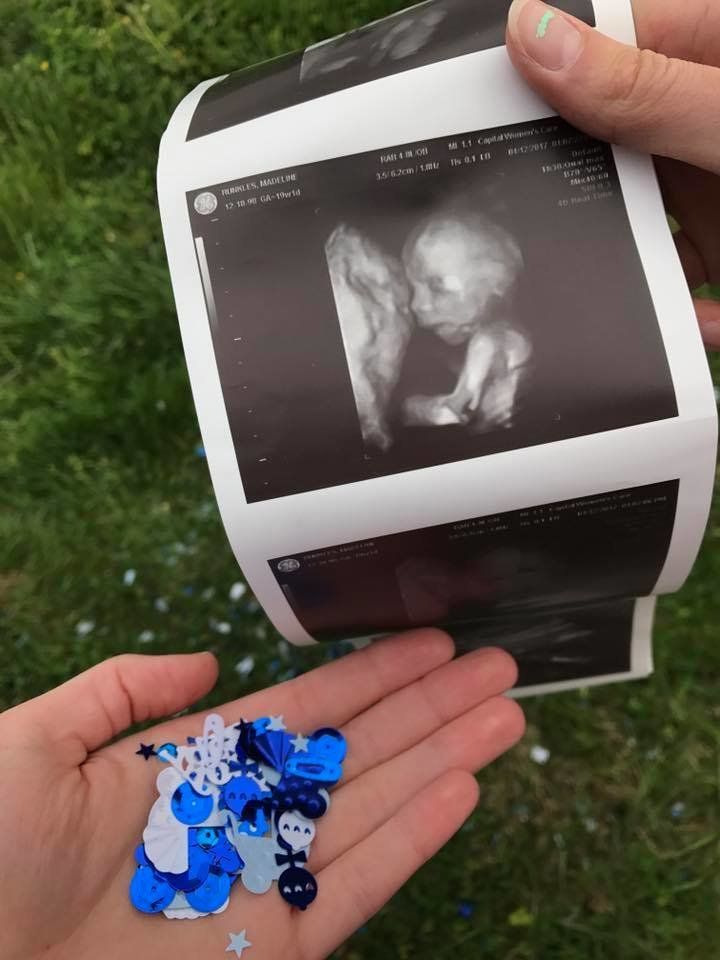 Maddi Runkles holding a recent sonogram image.
