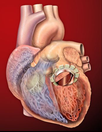 [CC by 2.0 | Image Credit: Patrick J. Lynch] Heart disease is the leading cause of death among women, yet it is underrepresented in research. 