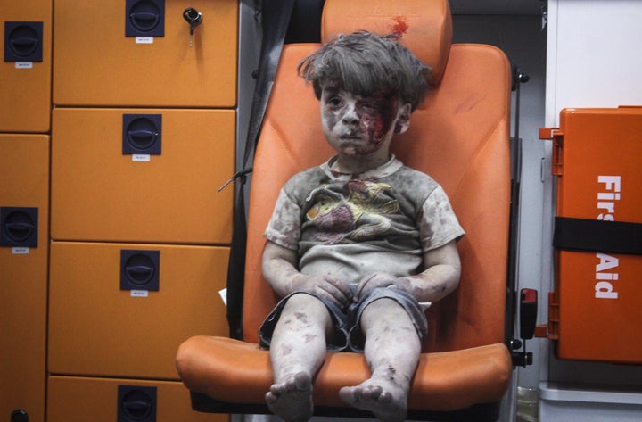 The image of Omran Daqneesh became an iconic one 