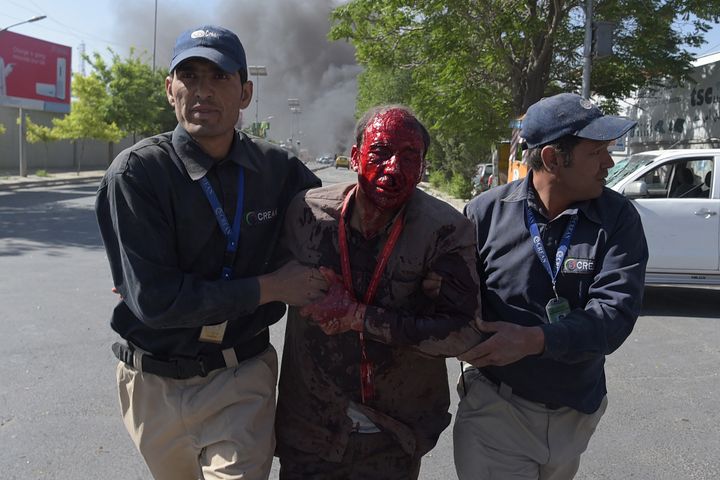 A wounded man is helped after a massive blast rocked Kabul's diplomatic quarter on Wednesday.