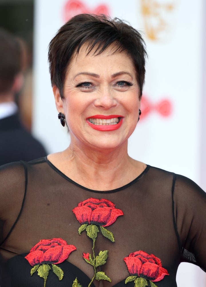 Denise Welch