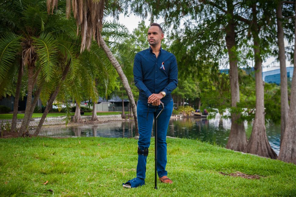 Angel Colon a survivor of the Pulse shooting poses for a photograph at Lake Eola Park in Orlando Florida on May 31 2017