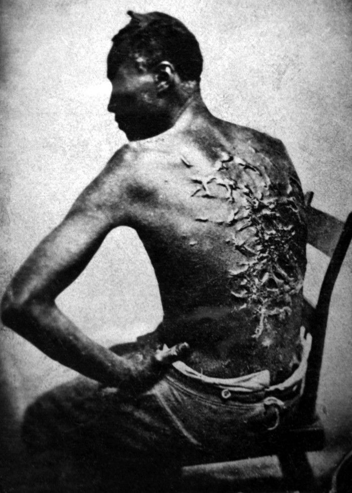 Gordon, or “Whipped Peter,” escaped captivity and ran 80 miles to join the Union Forces in Baton Rouge, Louisiana. This photo of the extensive scars on his back, from whippings received in enslavement, was taken while he was being fitted for a uniform. This is the CSA’s heritage. (Photo: M.B. Brady, March 1863).