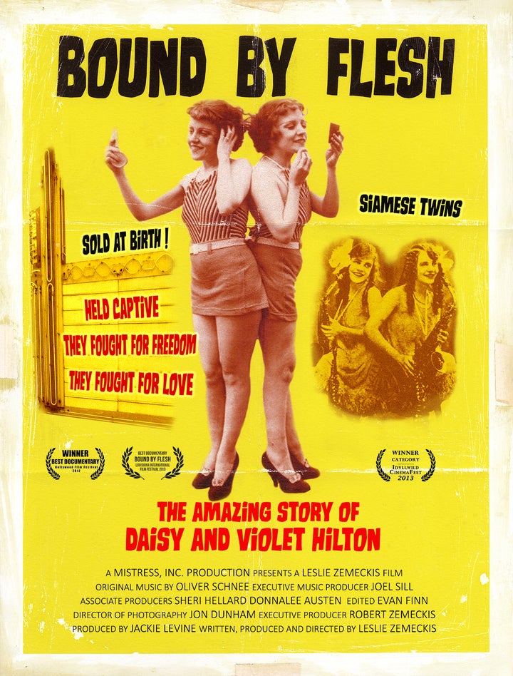 <p>Daisy and Violet Hilton - Siamese superstars on the carnival circuit</p>