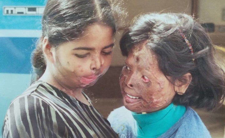 Nurjahan Khatun, right, survived an acid attack at age 9. The attacker was a man who was outraged that Nurjahan's 13-year-old