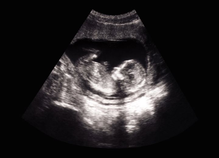 The foetus has the same constitutional rights as the mother under the Eighth Amendment (file picture)