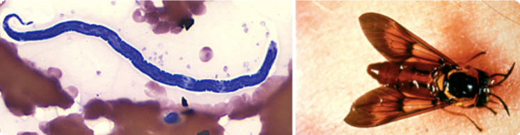 Left, a Loa loa microfilaria. Right, a deer fly.