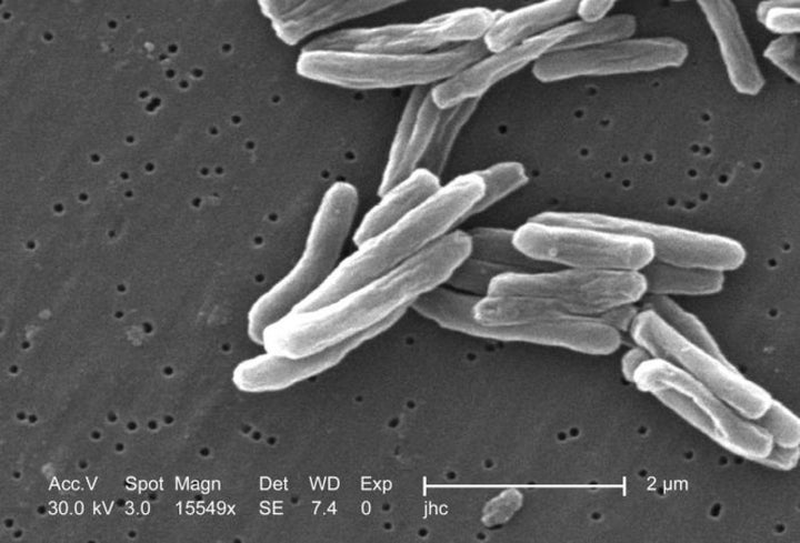 Under a high magnification of 15549x, a details of the Mycobacterium tuberculosis bacteria.