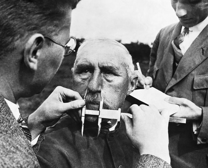 Nazi officials use calipers to measure an ethnic German's nose. The developed a system of facial measurement that was supposedly a way of determining racial descent