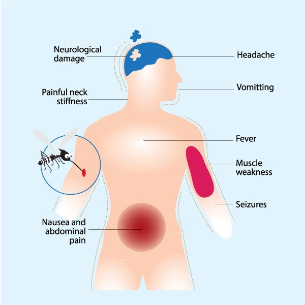  Japanese Encephalitis Symptoms 