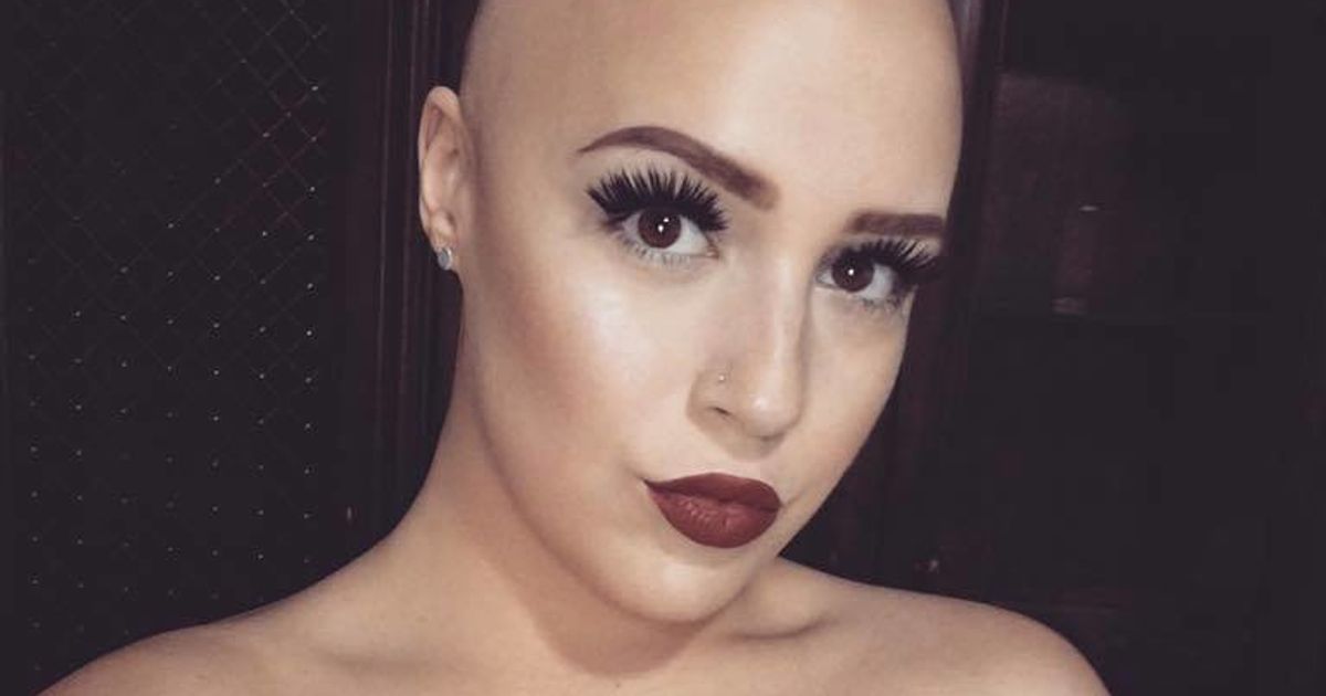 Woman With Alopecia Shares Inspiring Post About Feeling Beautiful Again Huffpost Health