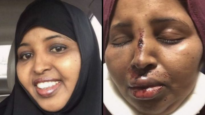 <p>Rahma Warsame was beaten unconscious in Columbus, Ohio.</p>