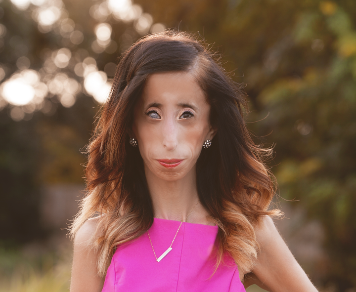 Lizzie Velasquez