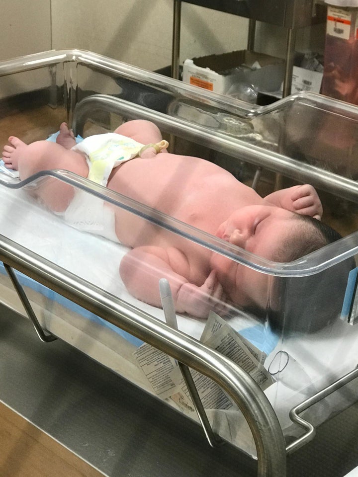 Colin's dad, Arthur Keisler, said his son "looked like a 5-month or 6-month-old baby" when he was born.