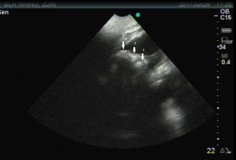 Three toes are visible in this image of the fetus’ foot. The white dots are toenails.