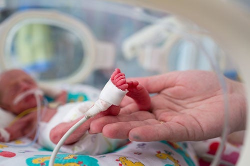 Premature baby
