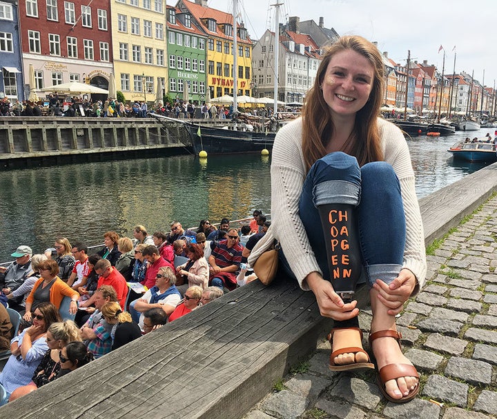 This Woman Turned Her Prosthetic Leg Into a Chalkboard to Document