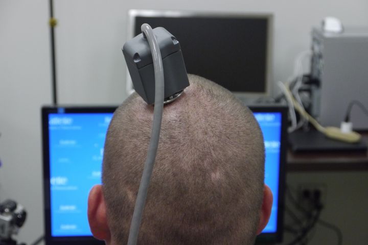 Ian Burkhart, 23, is connected to a computer via this port. A cable runs to a computer carrying information from the brain chip. He is then able to train his artificial arm.