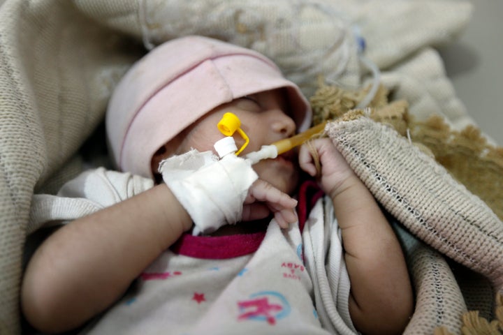 A Yemeni infant suspected of being infected with cholera receives treatment at Sabaeen Hospital in Sanaa, on June 13, 2017. Six weeks into the second outbreak of the deadly disease in less than a year, at least one patient checks in at Sabaeen every 60 seconds -- a level of emergency that overwhelms staff.