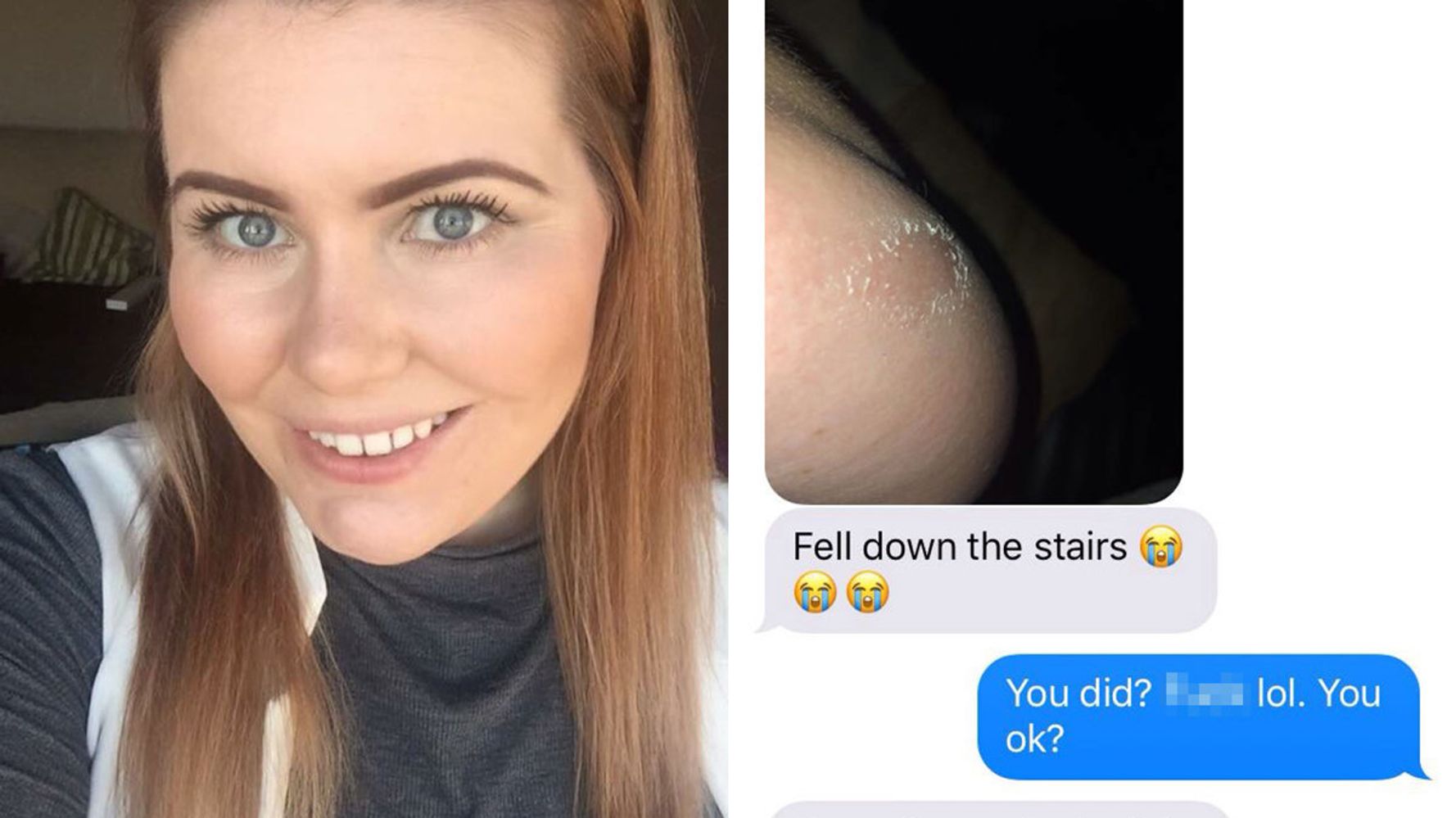 Mum Convinces 26-Year-Old Daughter Her Nipple Has Fallen Off In