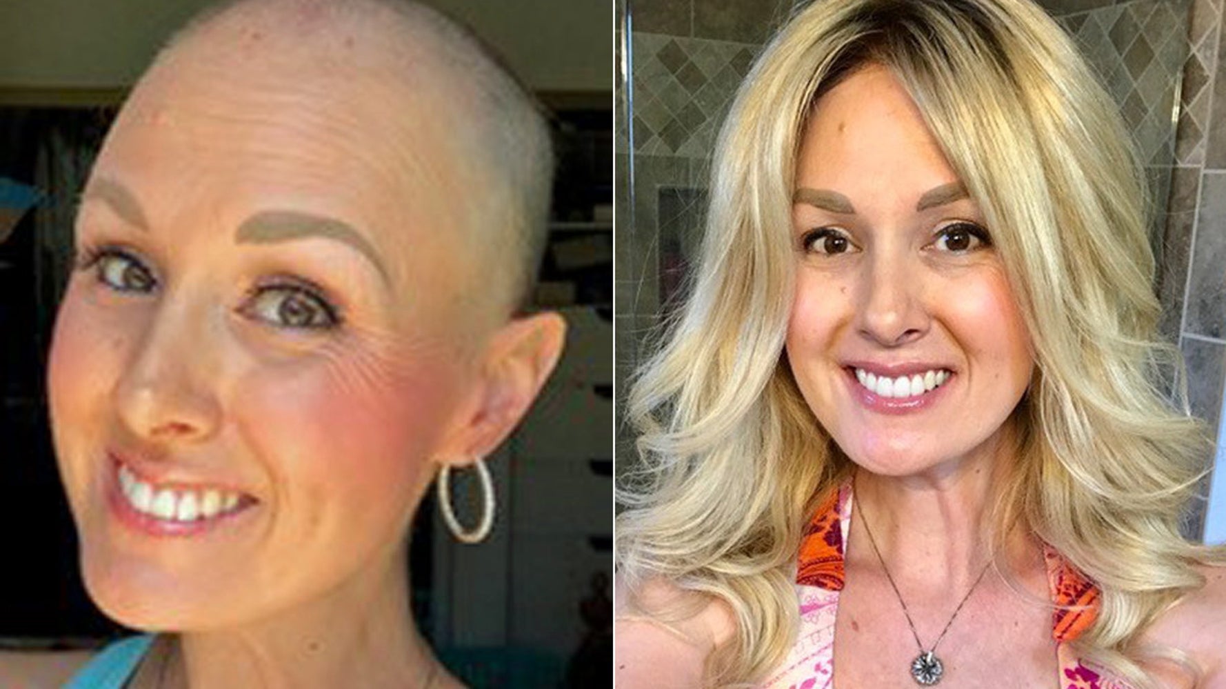 Cancer wigs deals