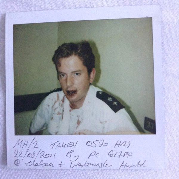 A polaroid taken of Sutherland in 2001, showing injuries he suffered after he was punched in the face on duty