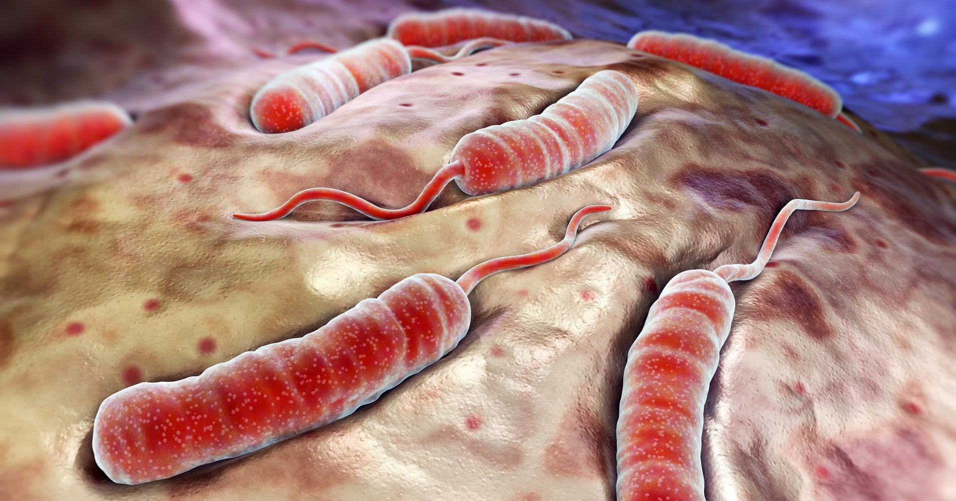 WHO Sees High Risk From Kenya Cholera Outbreak | HuffPost