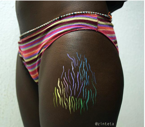 stretch marks - Stretch marks can alsoalso cancan even derive from nutritionaldietary deficiencies