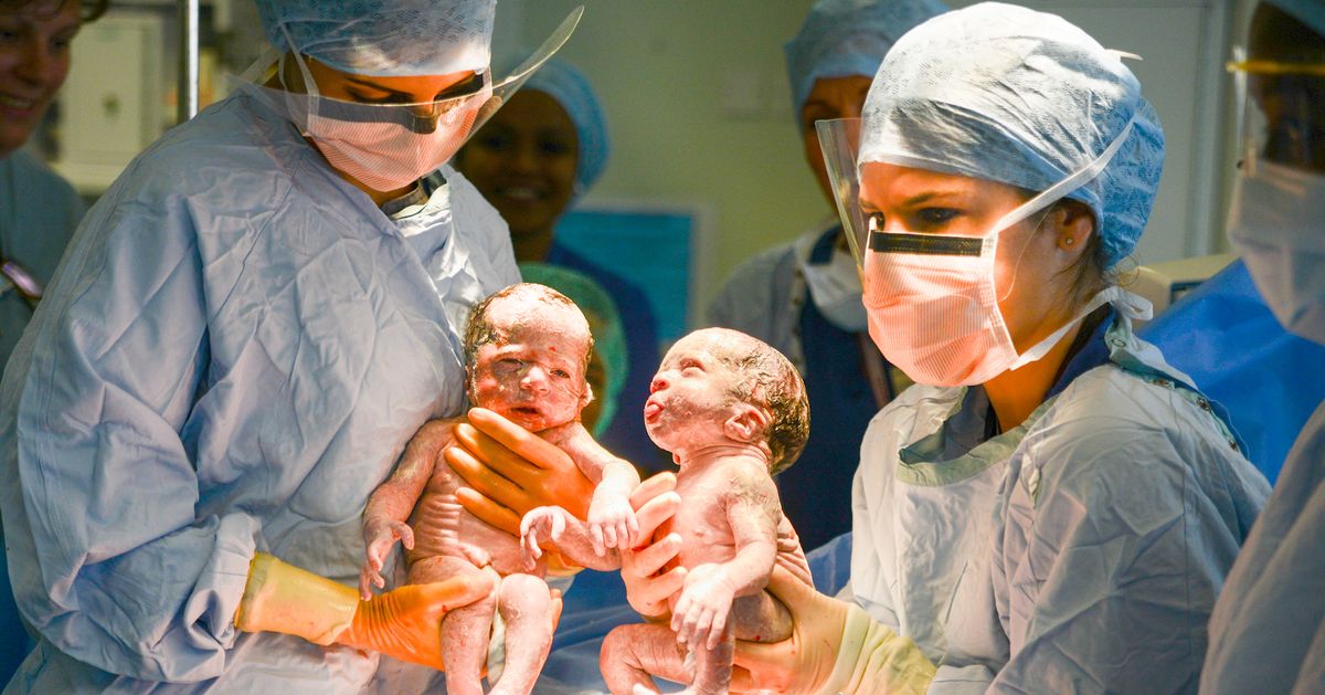 The World's First Twin Babies Measured Using Twin Pregnancy Growth
