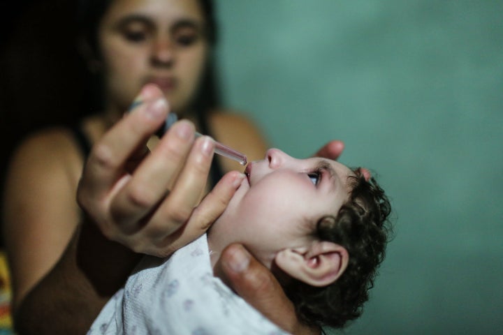 This photo shows an infant girl in Brazil born with an undersized skull and under-developed brain due to microcephaly, a rare birth defect caused by the Zika virus.