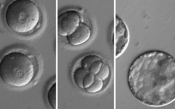 The development of embryos after injection of a gene-correcting enzyme and sperm.