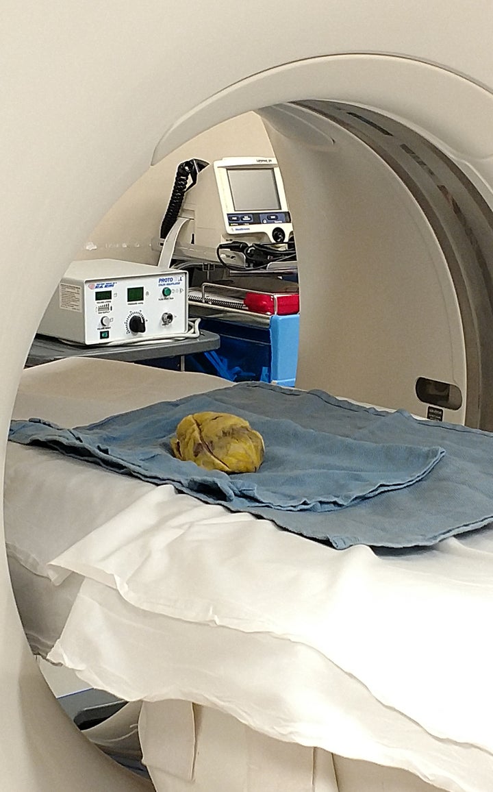 <p>My heart alone in a CT scanner. </p>