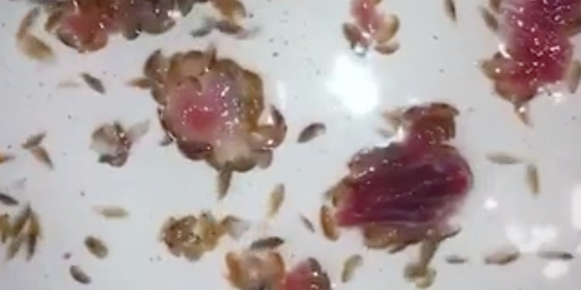 Melbourne Teenager Bloodied By Swarm Of Meat-Eating Sea Lice | HuffPost UK