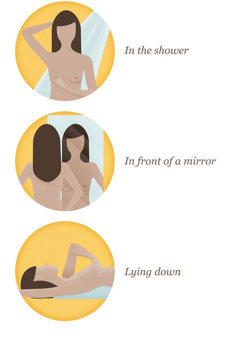 A breast self-exam can be performed: 1) in the shower, moving your fingers in a circular motion around the breasts while searching for a lump; 2) in front of a mirror, resting your arms on your sides to raising them above your head to putting your hands on your hips to see if there are differences in breast shape and form; and 3) lying down, massaging each breast with a pillow on the respective shoulder and using pressure to find unusual areas of density.