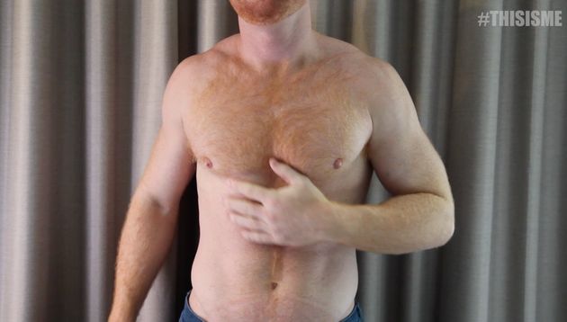 Gay Redhead Strips Down To Share His Personal Story For Thisisme Huffpost