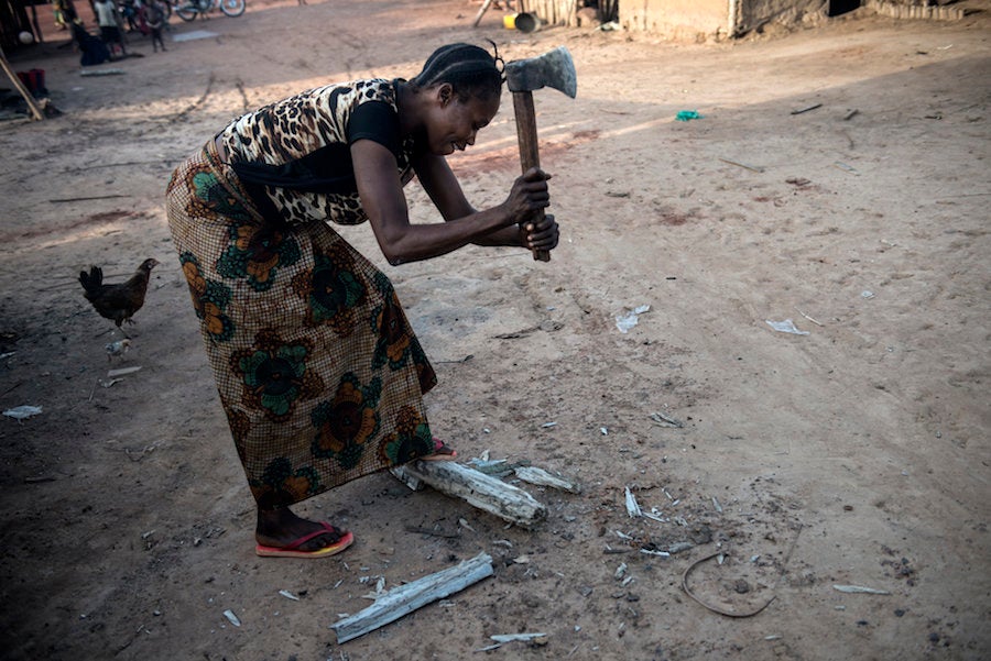 Bosumbuka said that because of his loss of sight, his wife now must provide for their family on her own.