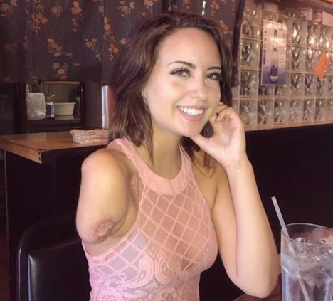 Woman Who Lost Her Arm Has A Hilariously Brilliant Tinder Bio - 468 x 423 png 296kB