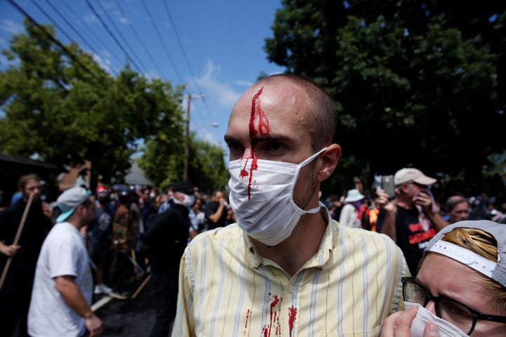 Clashes between white nationalist protesters and counter-protesters on Saturday left several people injured.