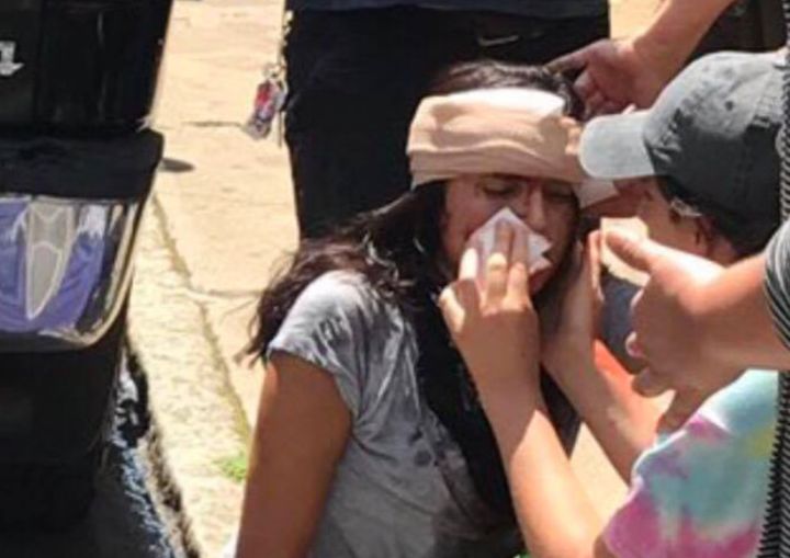 A picture of Natalie Romera receiving treatment after a car was driven into protesters in Charlottesville, Virginia