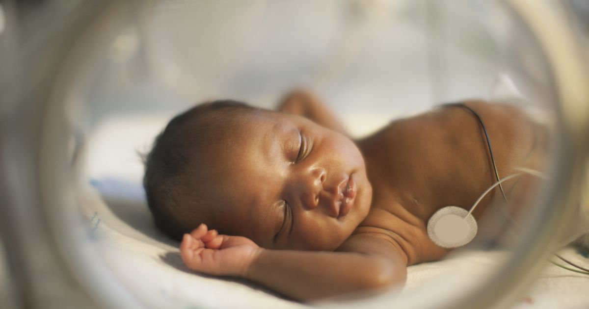 Premature Babies Remain At 'High Risk' Of Developmental