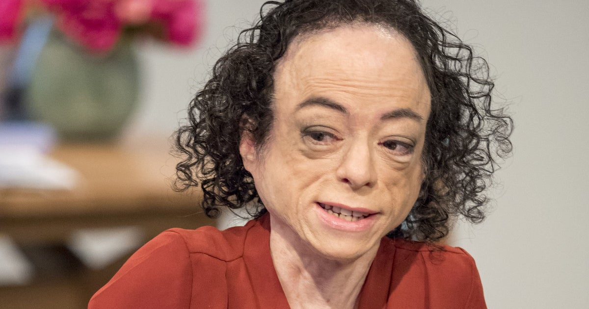 Liz Carr Liz Carr