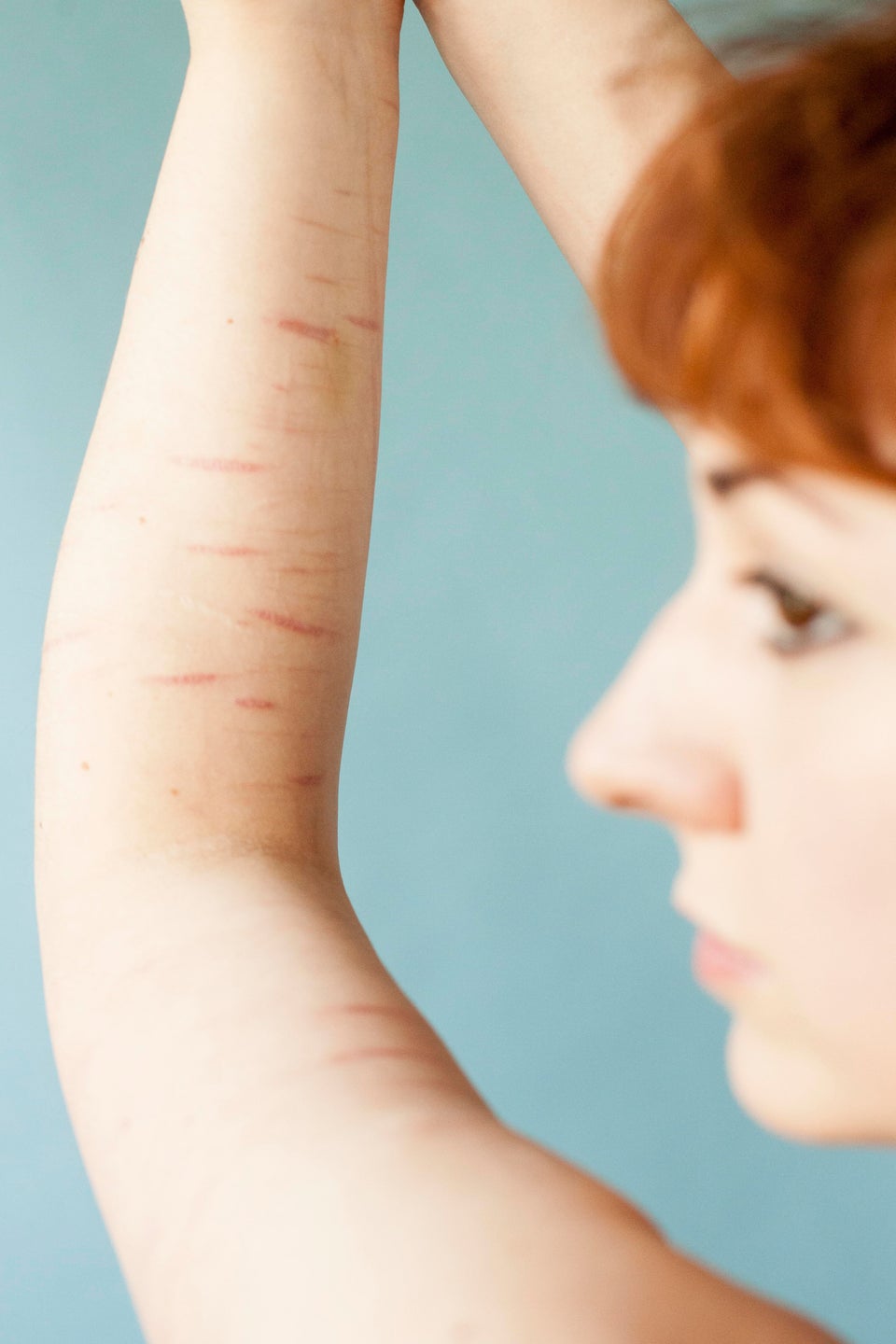 'Behind The Scars' The Poignant Photo Project Showing All Skin Is